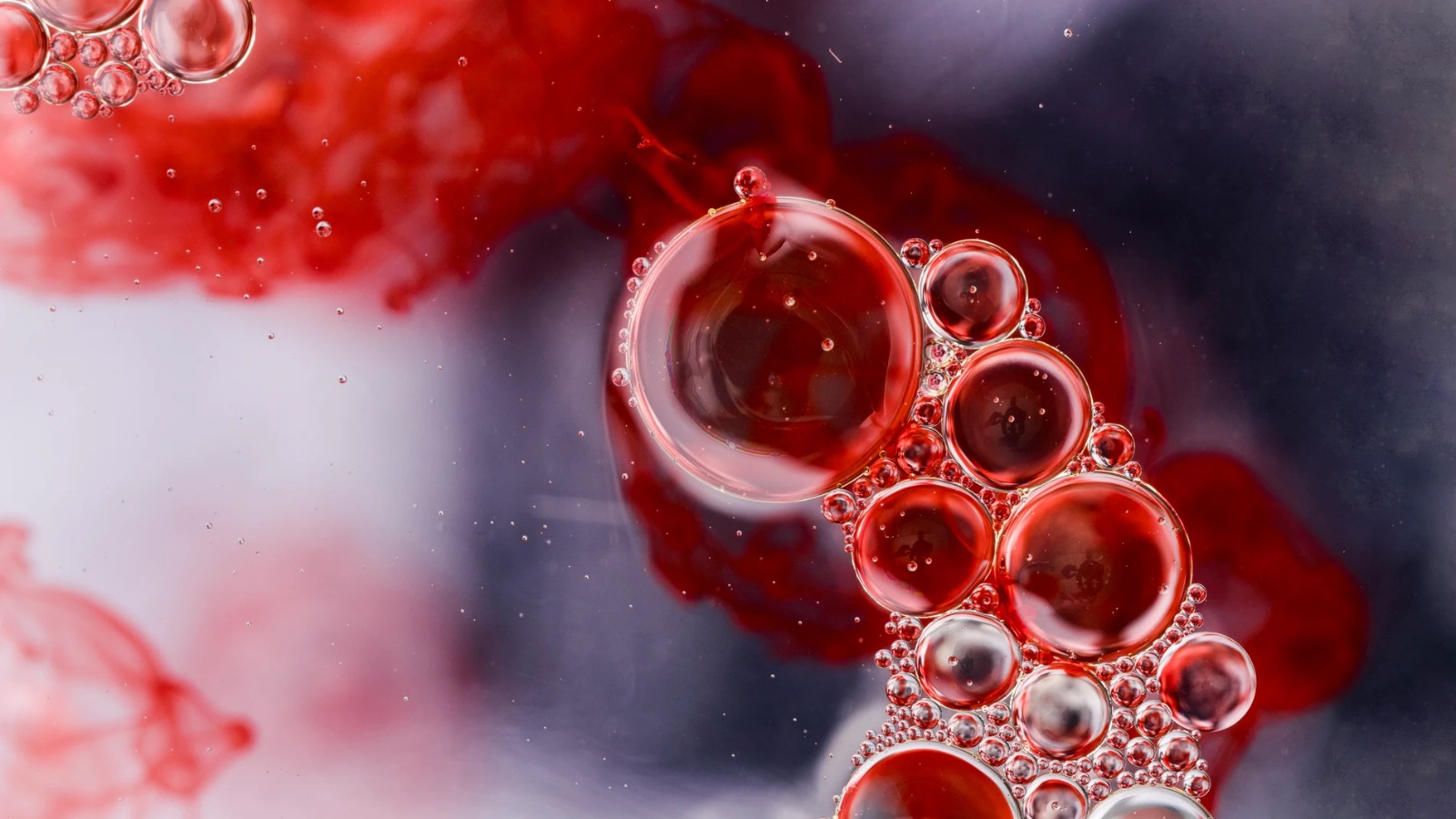 ¿Por qué los hombres son más propensos a desarrollar mieloma múltiple que las mujeres?